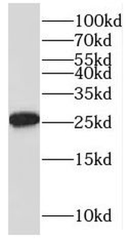 GINS4 Antibody