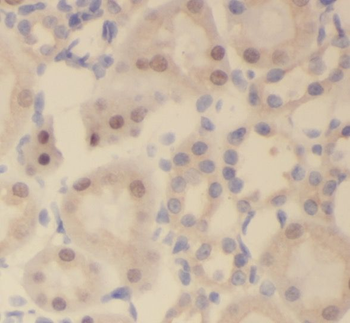 SLFNL1 Rabbit Polyclonal Antibody