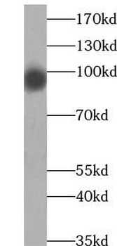 SLITRK6 Rabbit Polyclonal Antibody