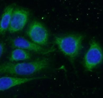 SLN Rabbit Polyclonal Antibody