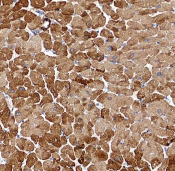 SLN Rabbit Polyclonal Antibody