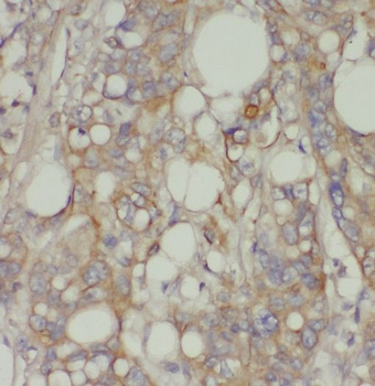 SLU7 Rabbit Polyclonal Antibody