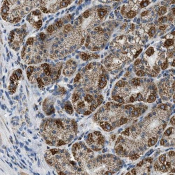 SMAP1 Rabbit Polyclonal Antibody