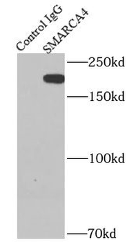 SMARCA4 Rabbit Polyclonal Antibody
