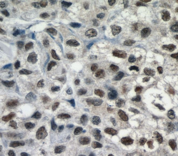 SMARCA4 Rabbit Polyclonal Antibody