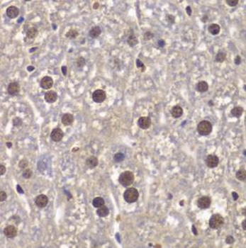 SMARCB1 Rabbit Polyclonal Antibody
