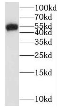 SMARCD2 Rabbit Polyclonal Antibody