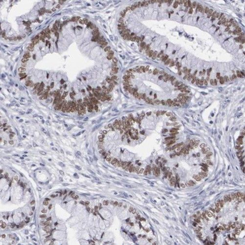 SMARCD2 Rabbit Polyclonal Antibody