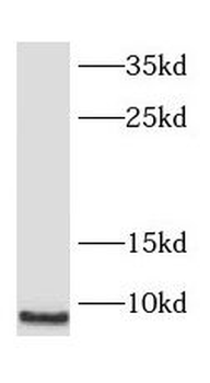 SMPX Rabbit Polyclonal Antibody