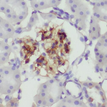 SMPX Rabbit Polyclonal Antibody