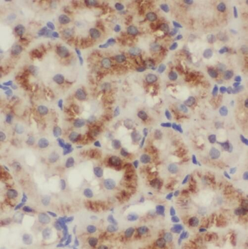 SMU1 Rabbit Polyclonal Antibody