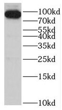 SMYD4 Rabbit Polyclonal Antibody