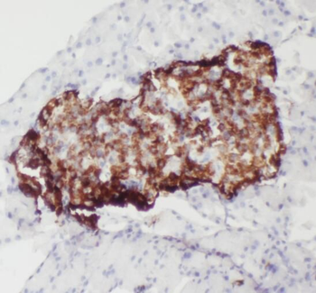 SMYD4 Rabbit Polyclonal Antibody