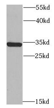 SNAP29 Rabbit Polyclonal Antibody