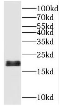 SNAPC5 Antibody