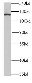 SND1 Antibody