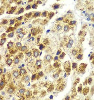 SND1 Rabbit Polyclonal Antibody