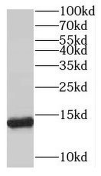 SNRPD3 Rabbit Polyclonal Antibody
