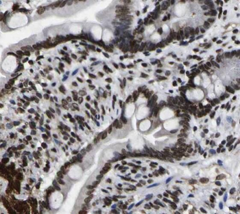 SNRPD3 Rabbit Polyclonal Antibody