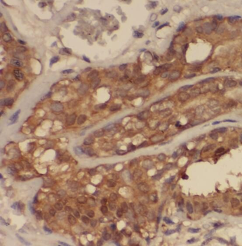 SNRPF Rabbit Polyclonal Antibody