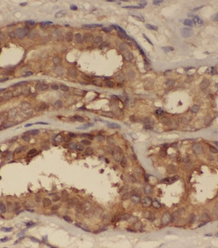 SNRPG Rabbit Polyclonal Antibody