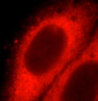 SNX17 Rabbit Polyclonal Antibody