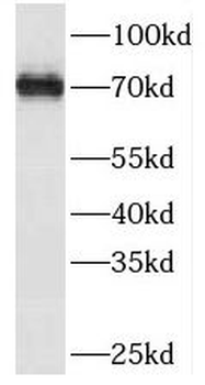 SESTD1 Antibody