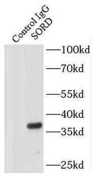 SESTD1 Rabbit Polyclonal Antibody
