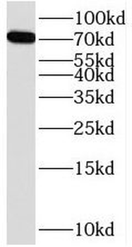 SORBS1 Antibody