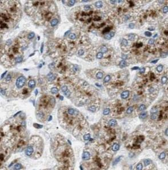 SOST Rabbit Polyclonal Antibody