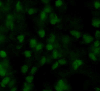 SOX2 Rabbit Polyclonal Antibody