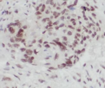 SOX2 Rabbit Polyclonal Antibody
