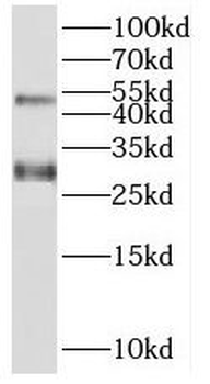 SPACA3 Antibody