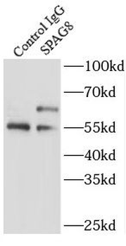SPAG8 Rabbit Polyclonal Antibody
