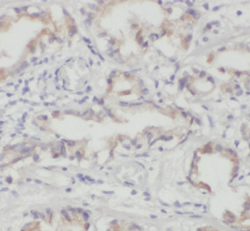 SPAG8 Rabbit Polyclonal Antibody