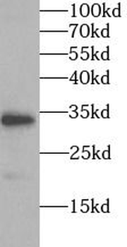 SPARC Rabbit Polyclonal Antibody