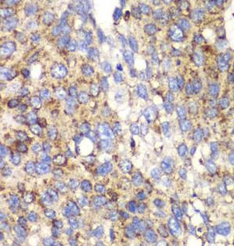 SPARC Rabbit Polyclonal Antibody