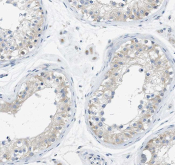 SPATA19 Rabbit Polyclonal Antibody