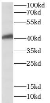 SPATA22 Rabbit Polyclonal Antibody