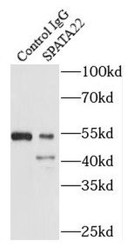 SPATA22 Rabbit Polyclonal Antibody