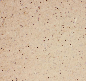 SPATA22 Rabbit Polyclonal Antibody