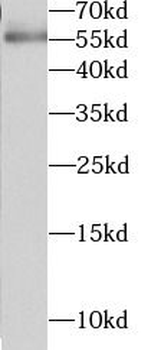 SPHK1 Rabbit Polyclonal Antibody