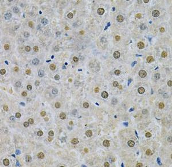 SPHK1 Rabbit Polyclonal Antibody