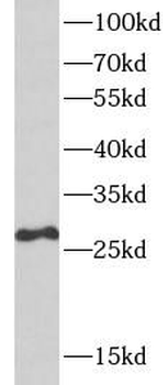 SPR Rabbit Polyclonal Antibody