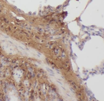 SPR Rabbit Polyclonal Antibody