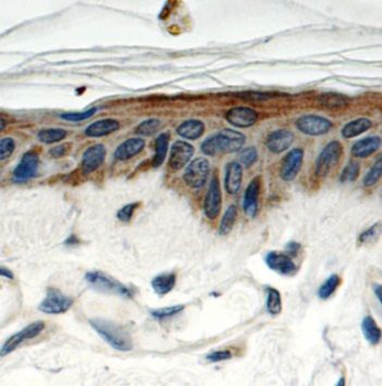 SPRR1B Antibody