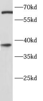 SPRY2 Antibody