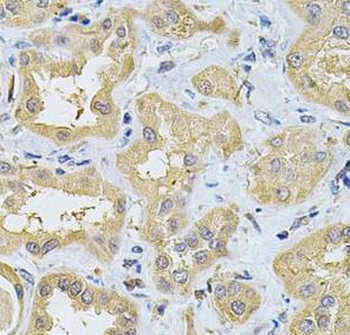 SPTLC1 Rabbit Polyclonal Antibody