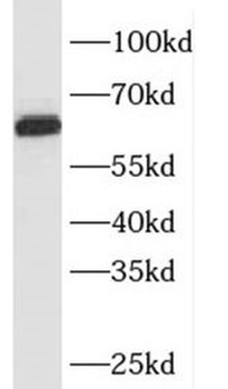 SQLE Antibody