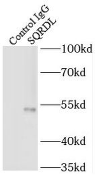 SQOR Rabbit Polyclonal Antibody